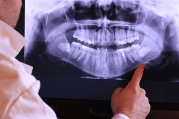 Best Emergency Dental Surgery in William Paterson University Of New Jersey, NJ